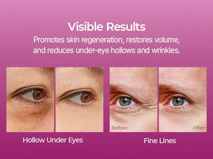 Calcium Volume Multi Balm – Lift, Smooth & Anti-Aging Bye Wrinkles, Hello Fresh Skin (9g)