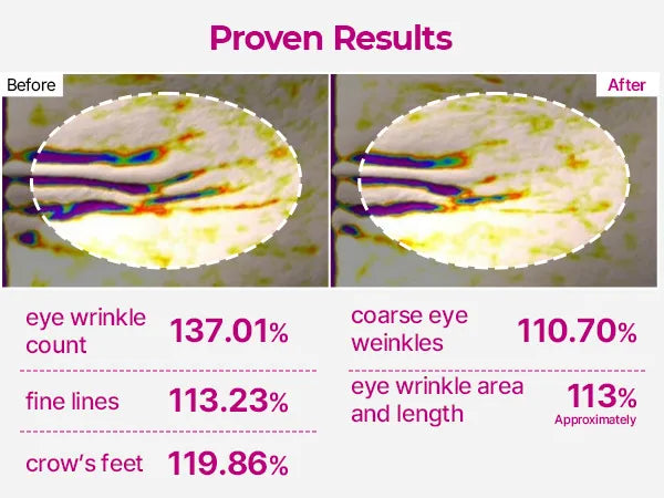 Calcium Volume Multi Balm – Lift, Smooth & Anti-Aging Bye Wrinkles, Hello Fresh Skin (9g)